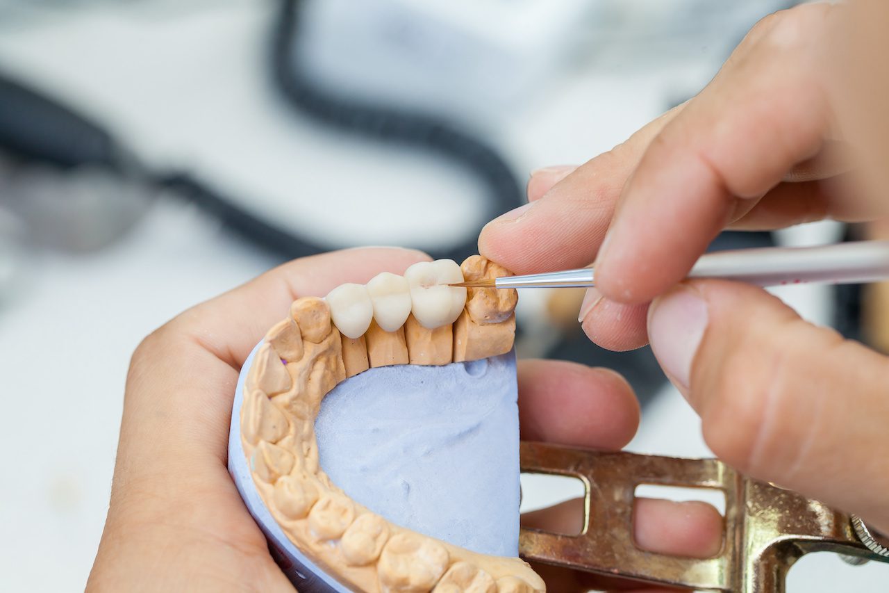 dental technician working on model of jaw with teeth