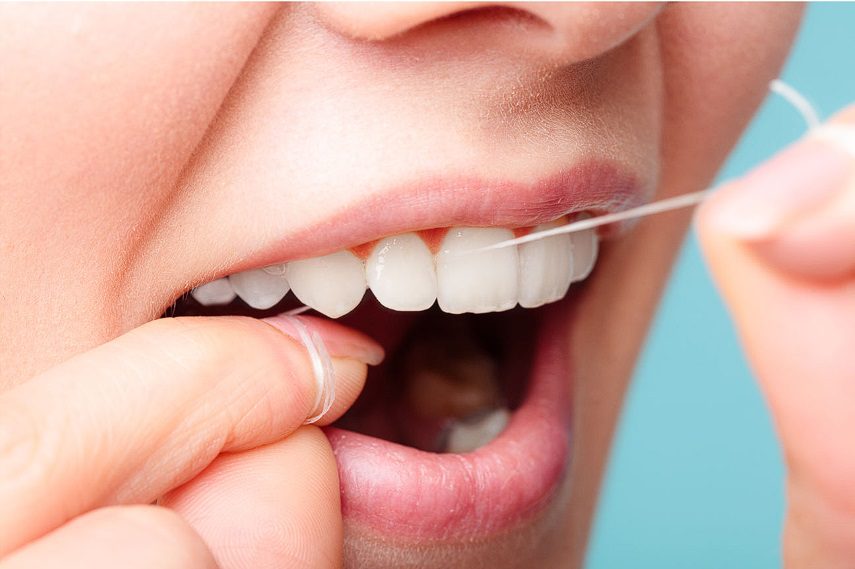 Practical Flossing Techniques for Stroke Risk Reduction