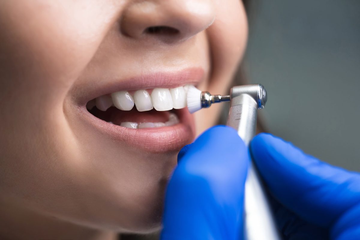 Family-Friendly Teeth Cleaning and Plaque Disclosure